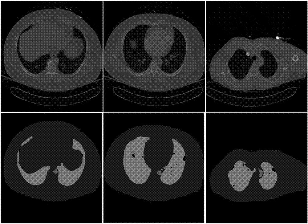End-to-end chest CT image segmentation method based on fully convolutional neural network
