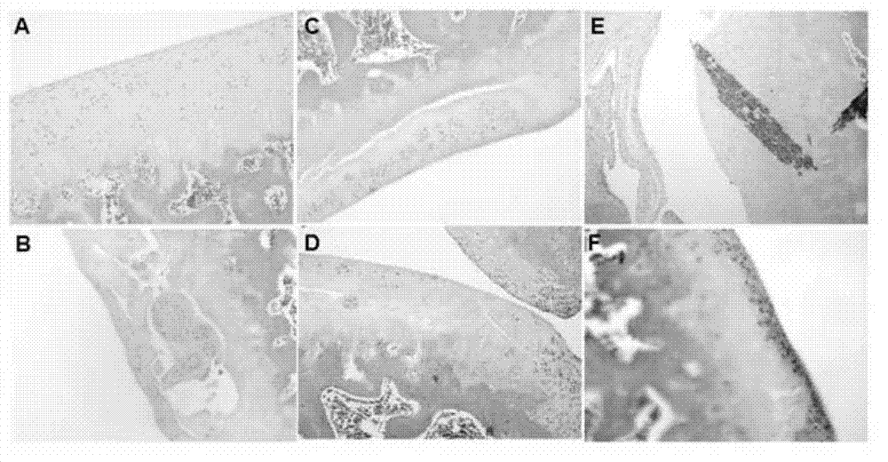 Method for inducing differentiation from mesenchymal stem cells to cartilage cells and application of mesenchymal stem cells in osteoarthritis