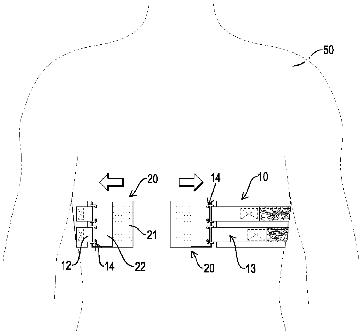 rib support device