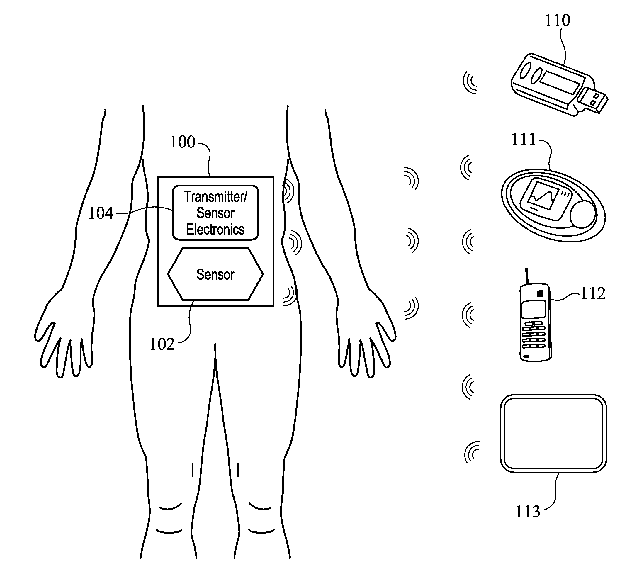 Systems and methods for processing analyte sensor data