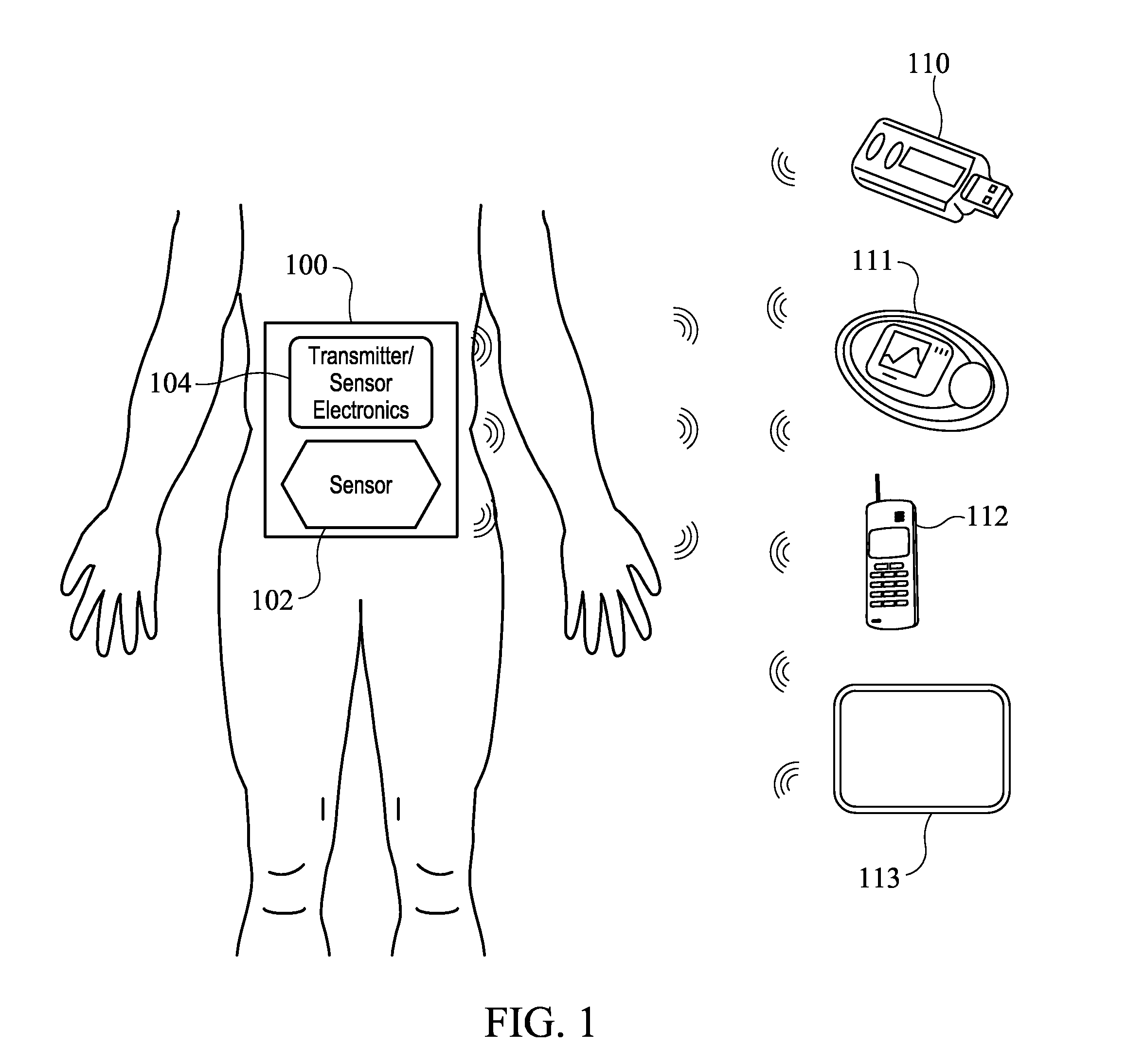 Systems and methods for processing analyte sensor data