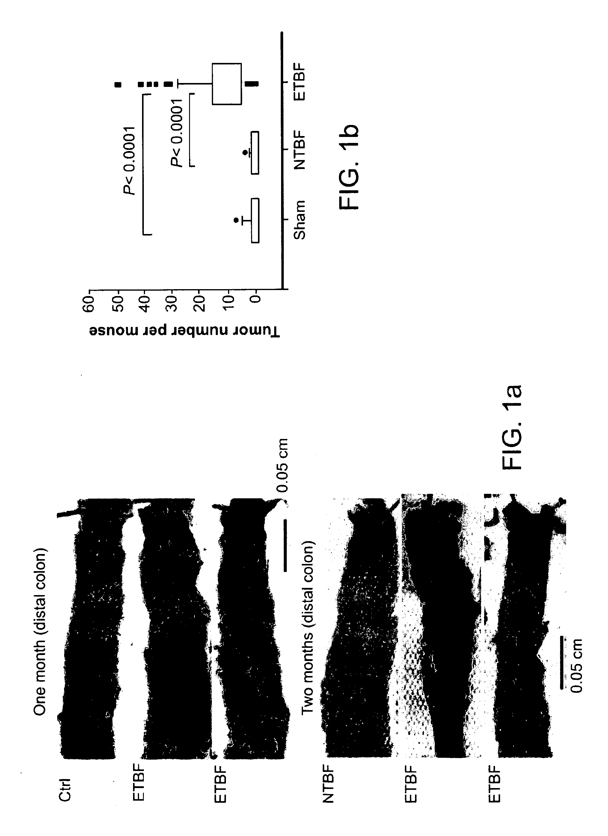 Compositions and methods for treating or preventing inflammatory bowel disease and colon cancer