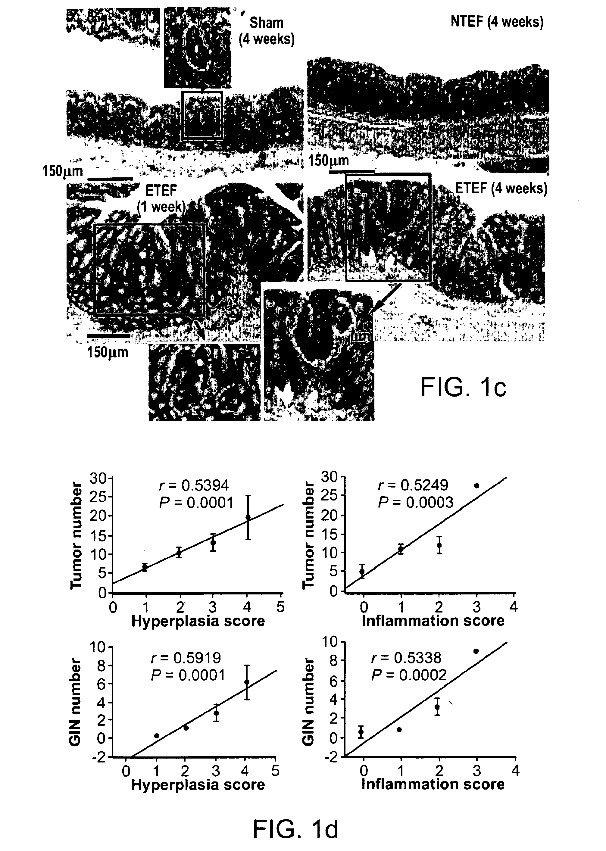 Compositions and methods for treating or preventing inflammatory bowel disease and colon cancer