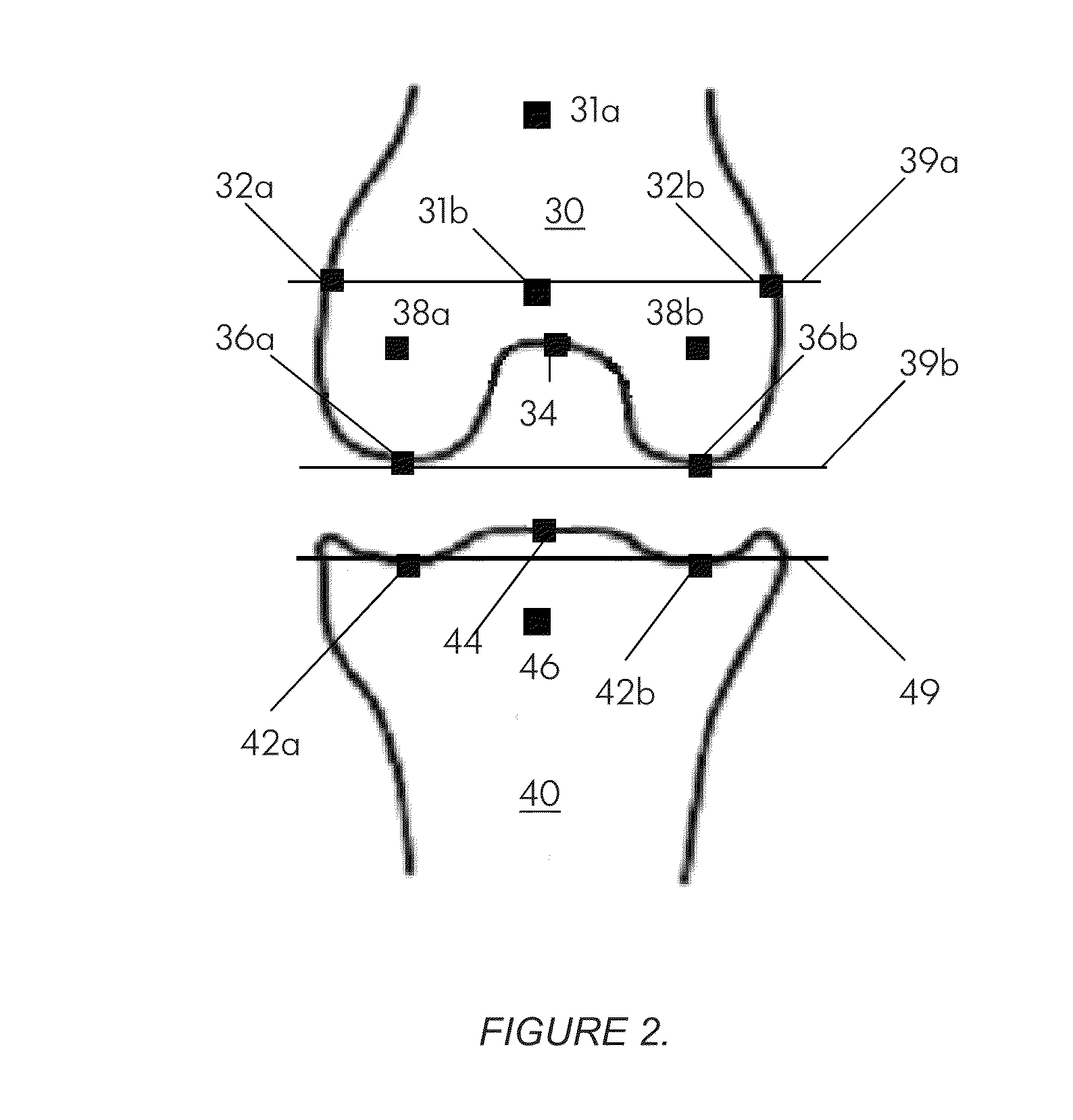 Systems and methods for determining the mechanical axis of a femur