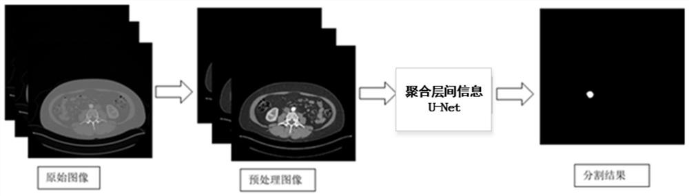 U-Net kidney tumor image segmentation method and device based on aggregation interlayer information, and storage medium