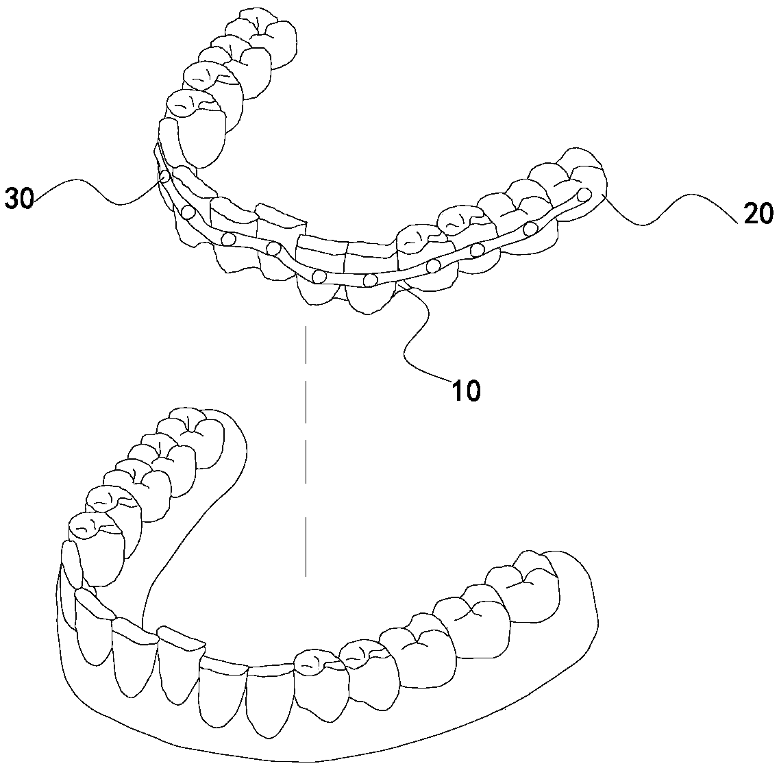Tooth socket for invisible dental orthodontics and set for dental orthodontics