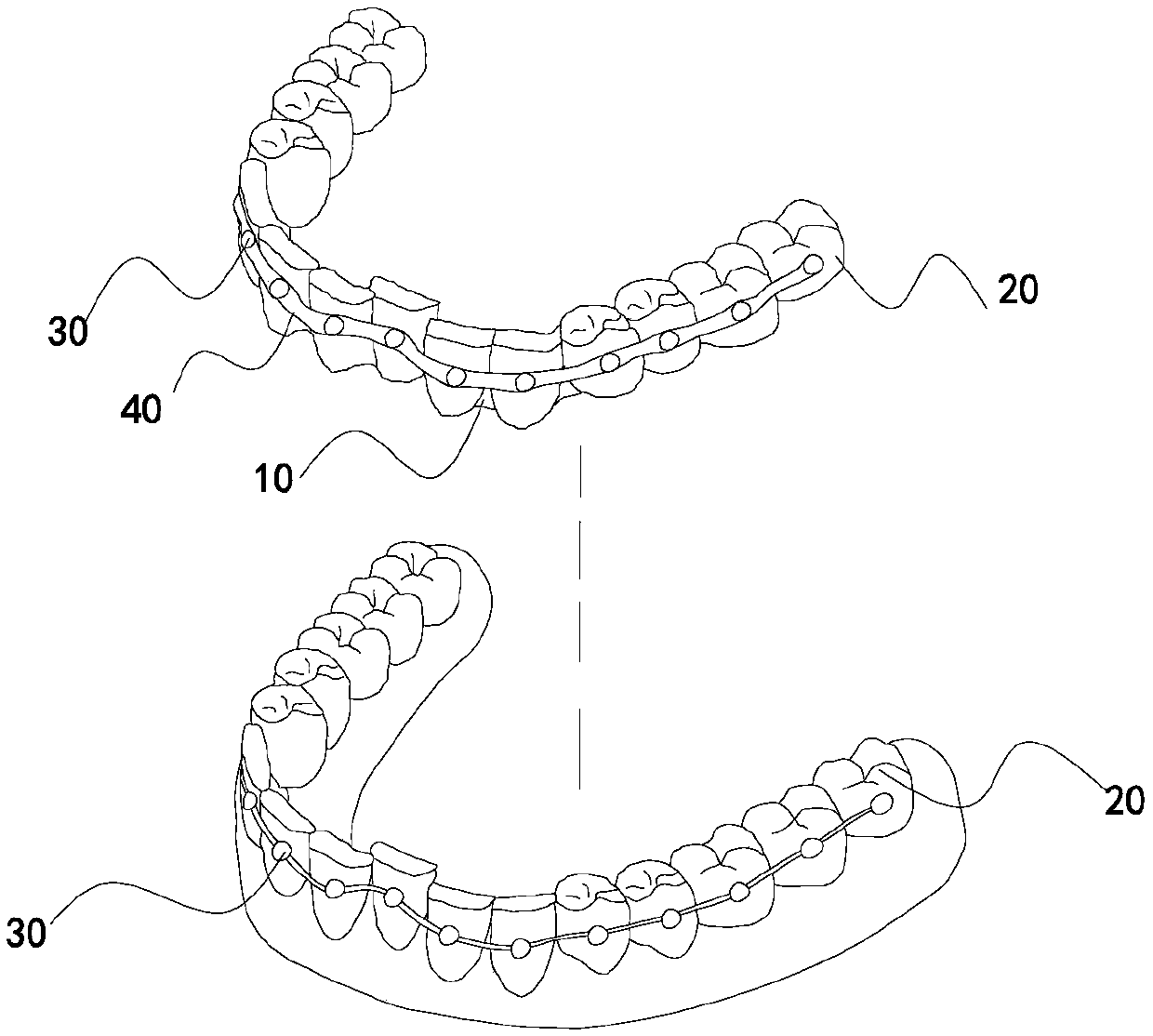 Tooth socket for invisible dental orthodontics and set for dental orthodontics