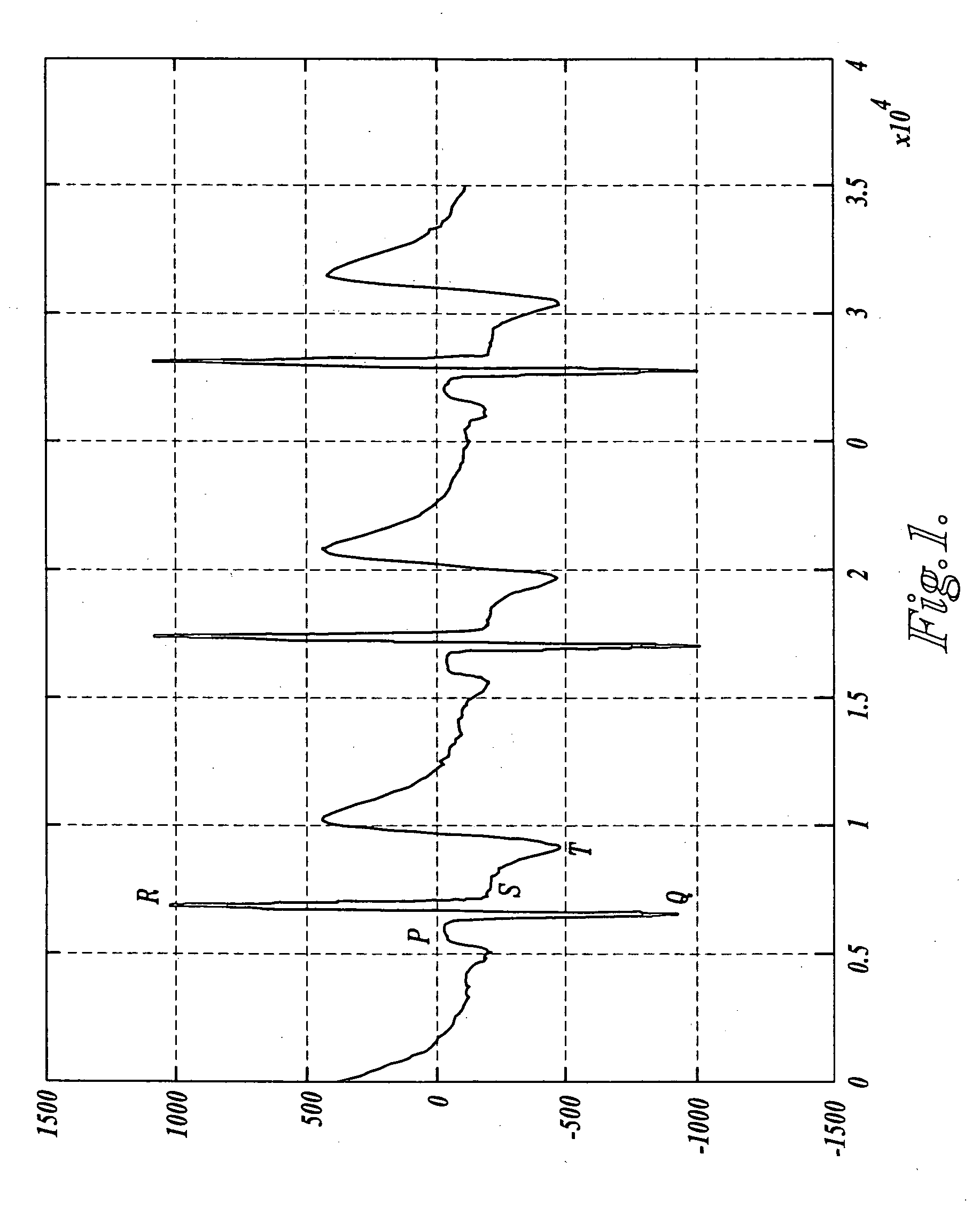 Apparatus, software, and methods for cardiac pulse detection using a piezoelectric sensor