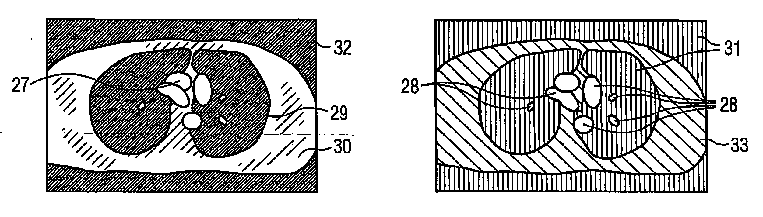 Method and magnetic resonance tomography apparatus for producing phase-coded flow images