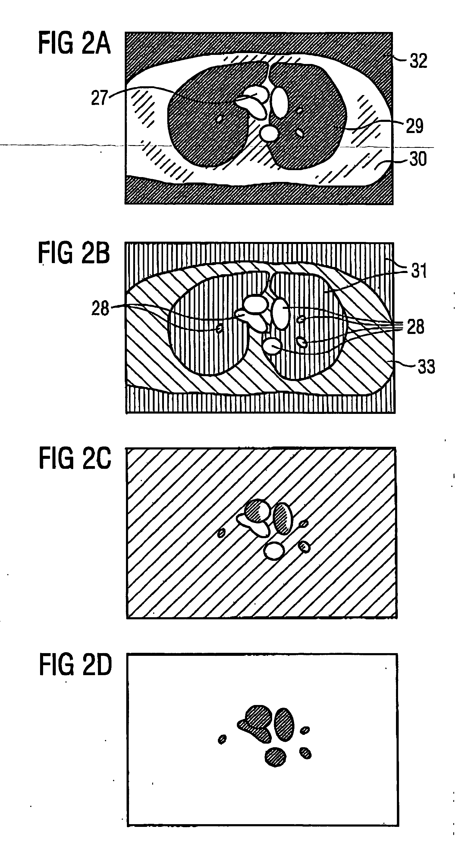 Method and magnetic resonance tomography apparatus for producing phase-coded flow images
