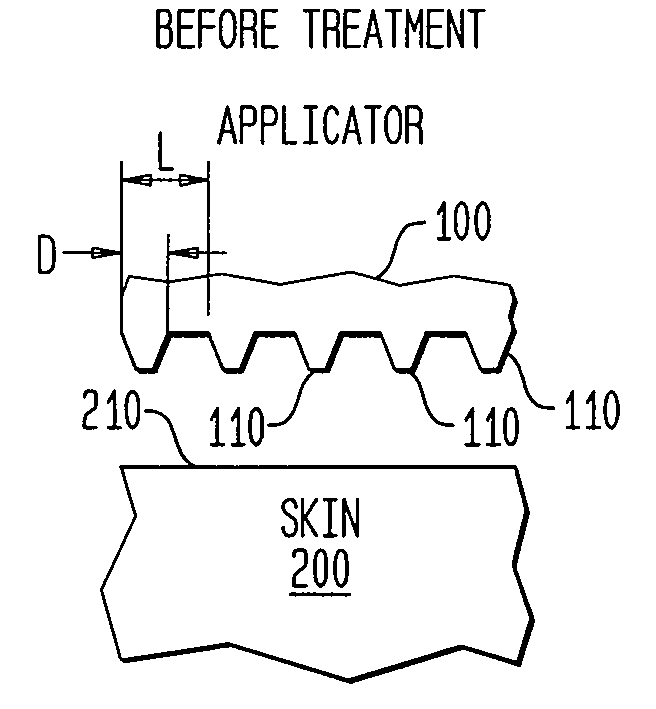 Method and apparatus for treatment of tissue