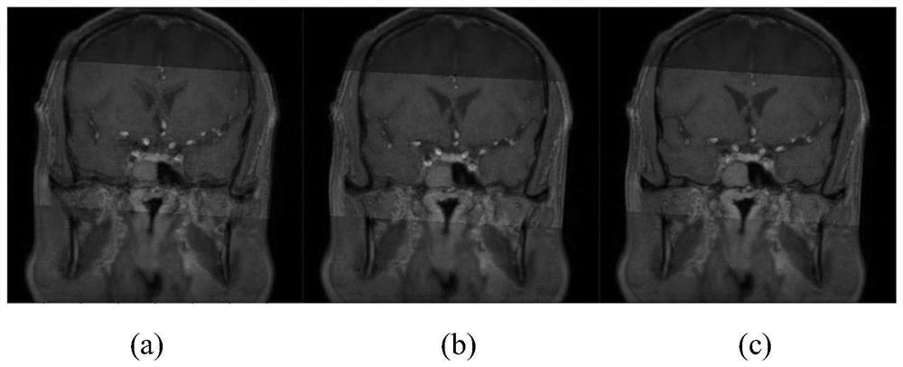 Intracranial blood vessel image flow void artifact elimination method and system