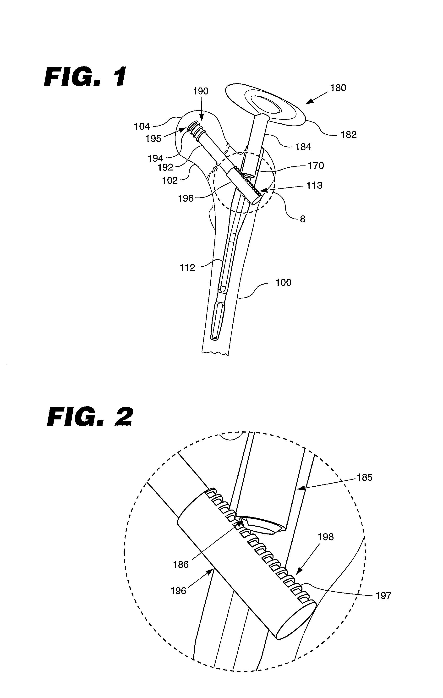 Methods and Instruments of Reducing a Fracture