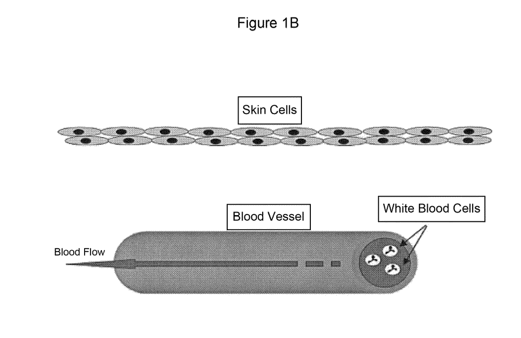 Compositions and Methods for Treating Burns