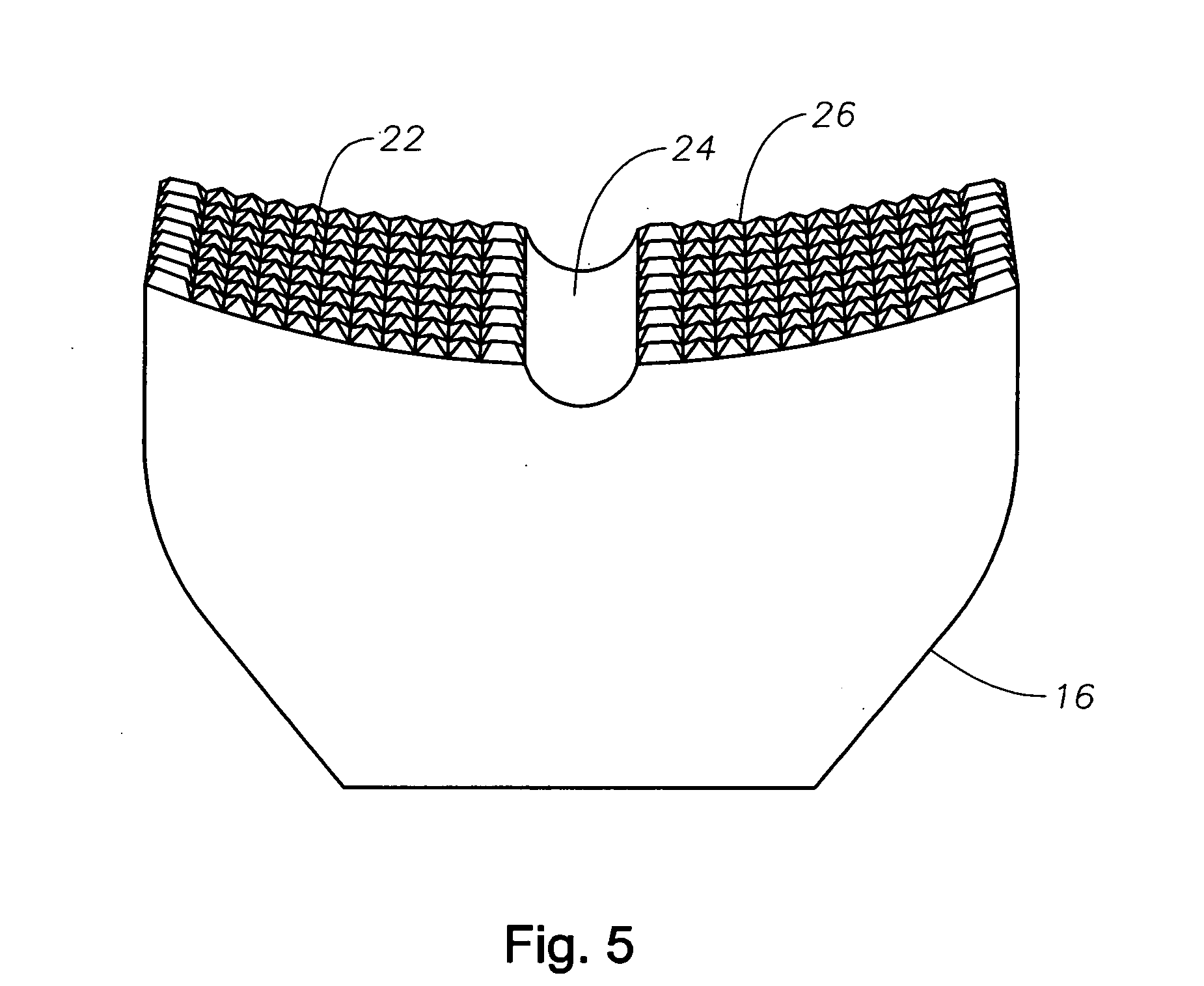 Counter pressure device for ophthalmic drug delivery