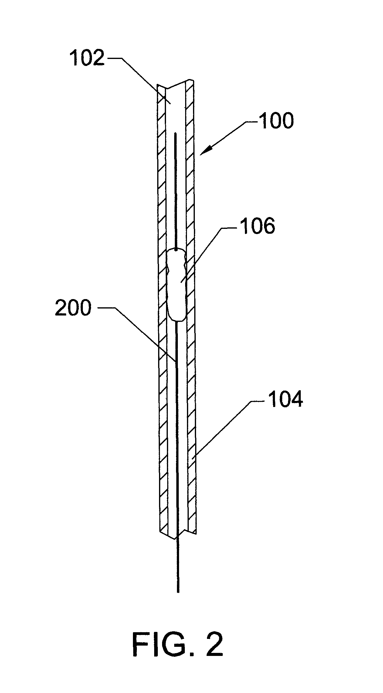 Thrombectomy system and method