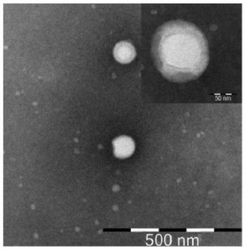 A siliceous nanoparticle drug carrier and its diagnostic and therapeutic preparation and preparation method