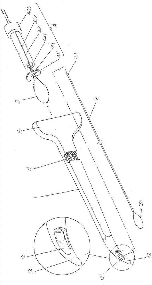 Anal fistula oriented seton stringing device