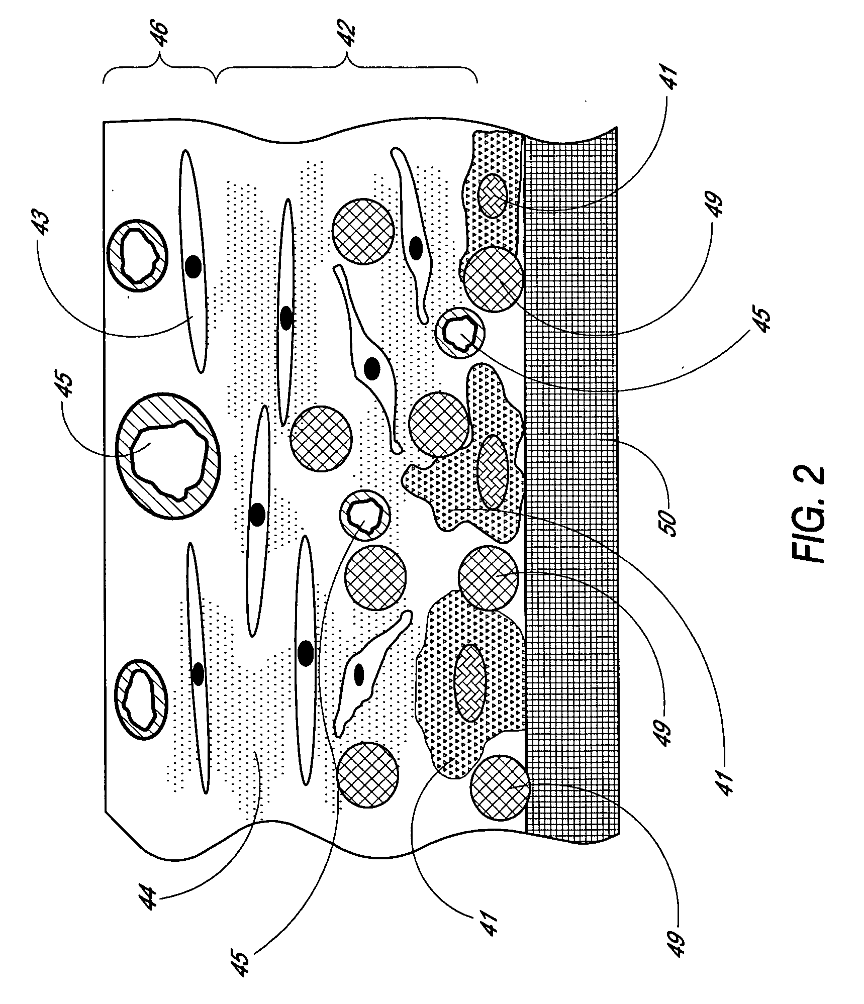 Analyte sensing biointerface