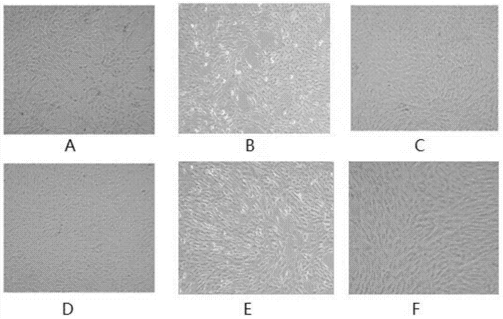 Culture medium for mesenchymal stem cells and large-scale culture method thereof