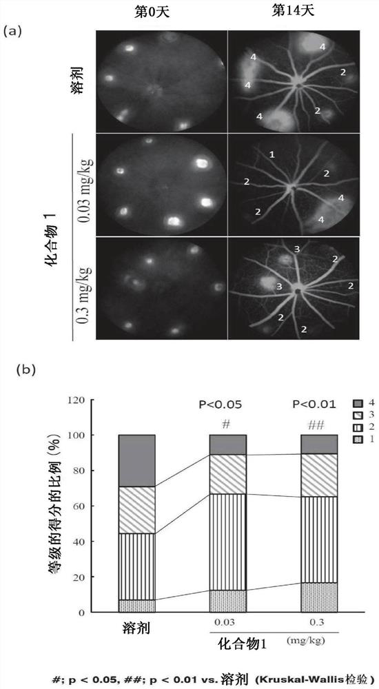 Medicine for preventing or treating ophthalmic disease associated with enhanced intraocular neovascularization and/or intraocular vascular permeability
