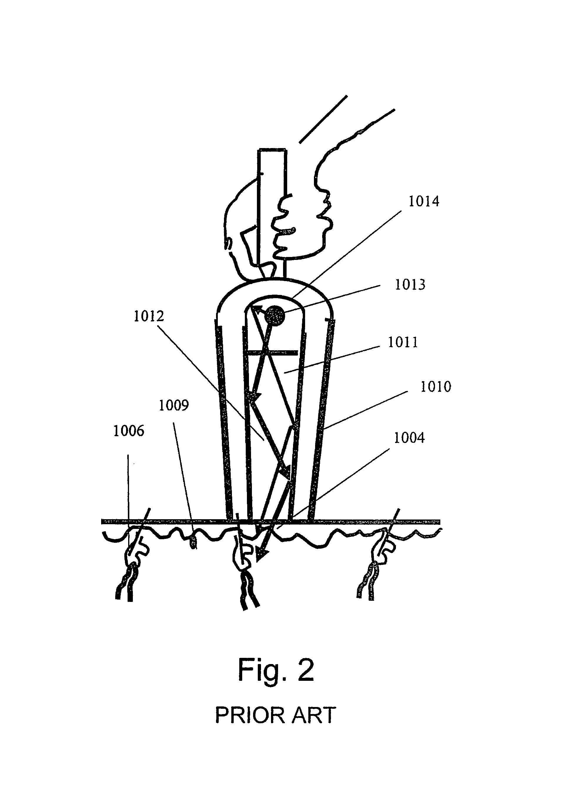 Method and apparatus for vacuum-assisted light-based treatments of the skin