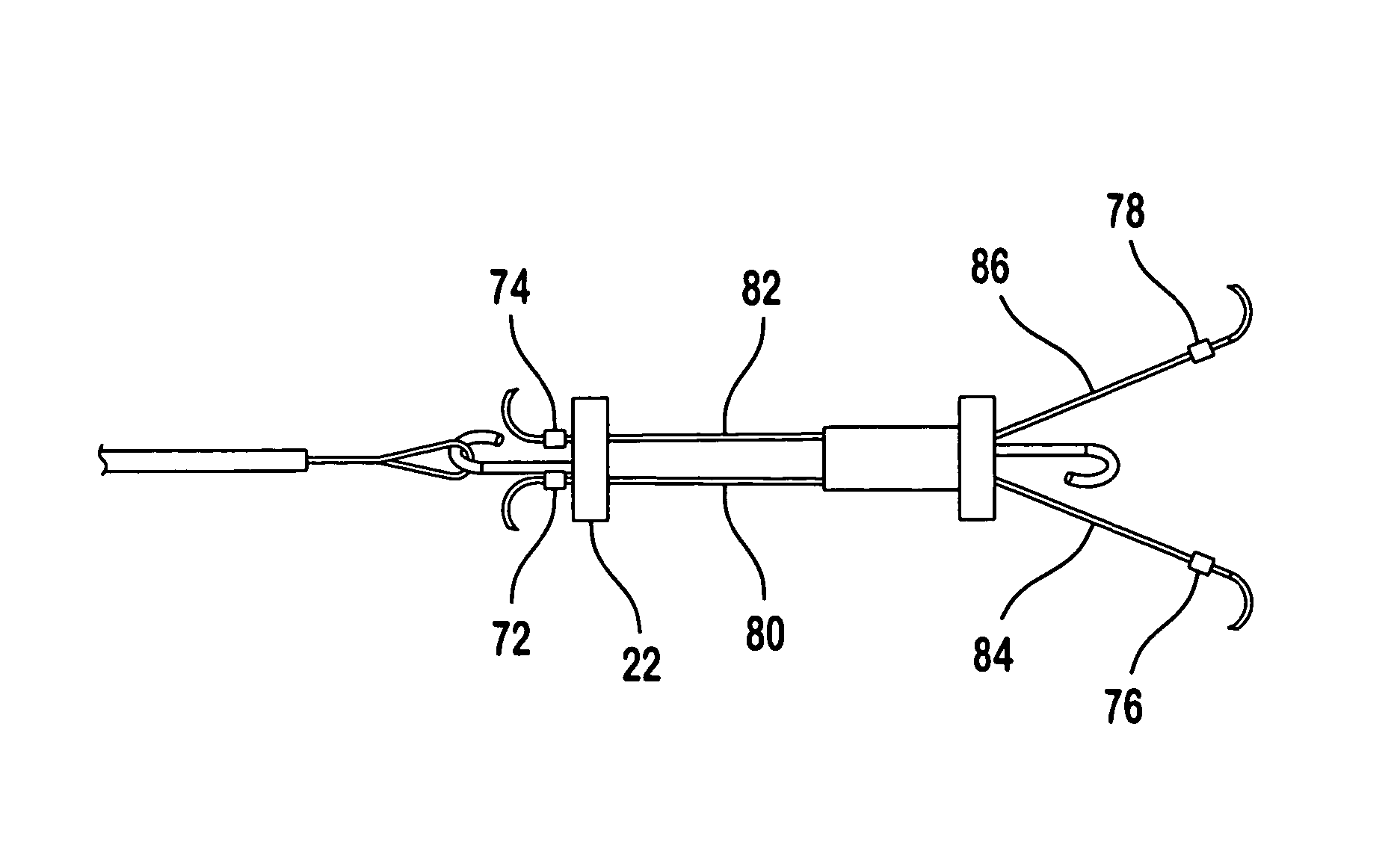 Retrievable filter