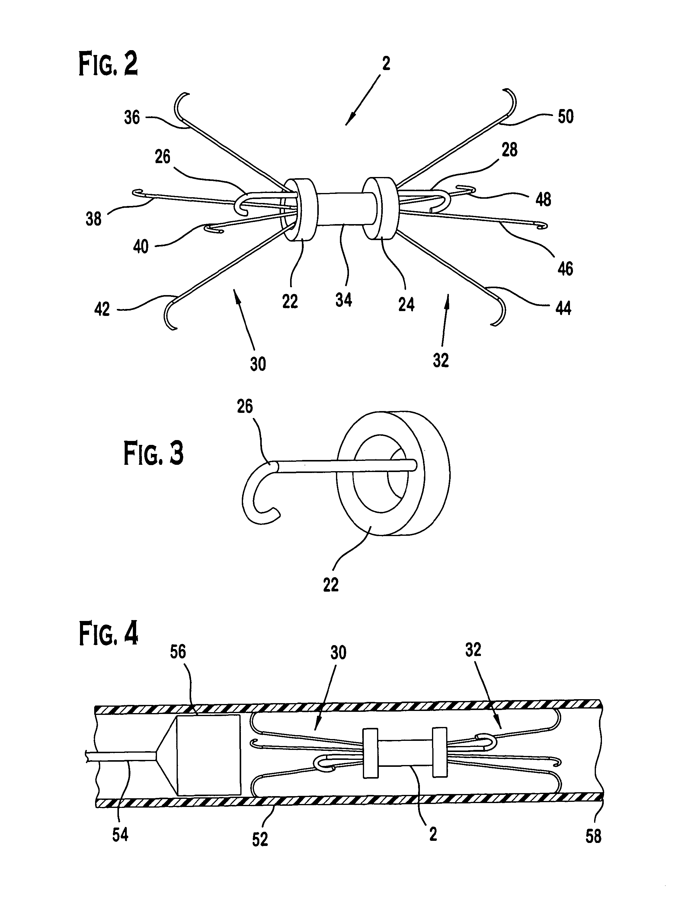 Retrievable filter