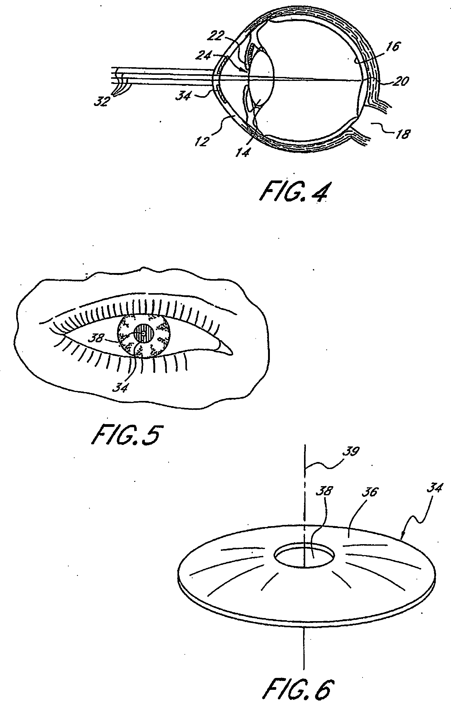 System and method for aligning an optic with an axis of an eye