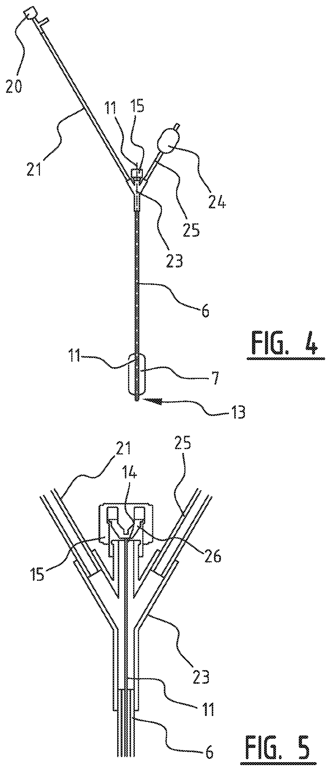 System with an inflatable member for being arranged in the patient's respiratory tract