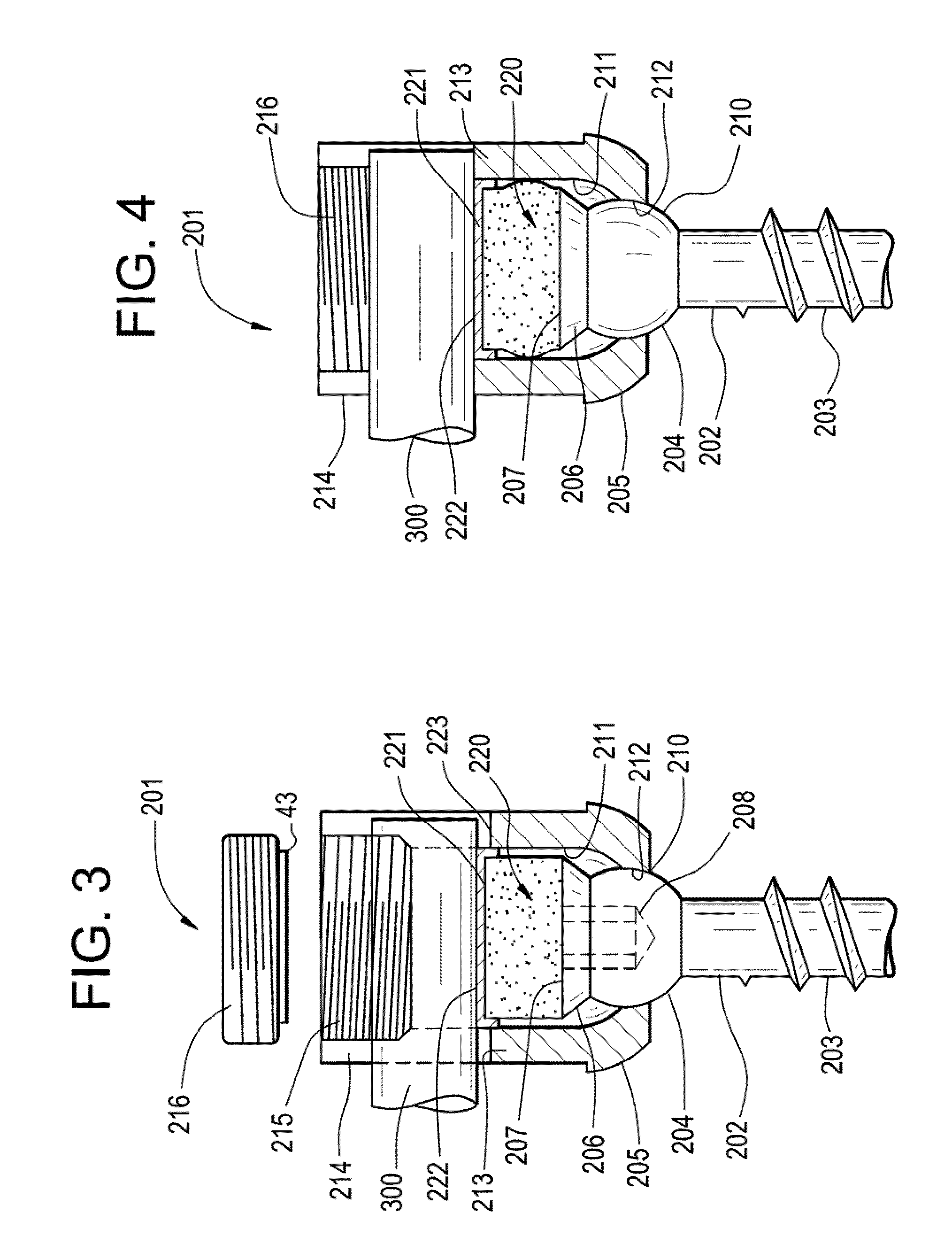 Posterior Dynamic Stabilization Device Having A Mobile Anchor