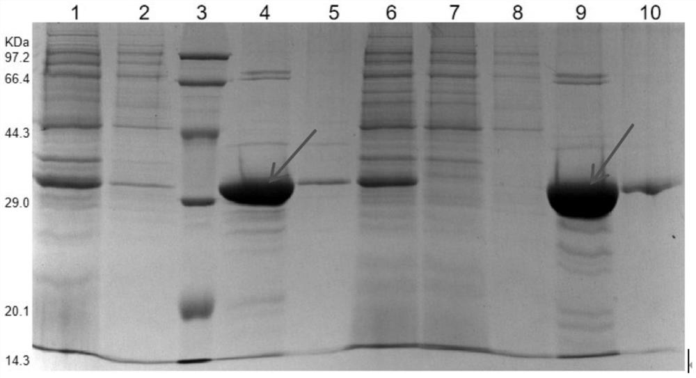 Group b meningococcal vaccine and its preparation method and application