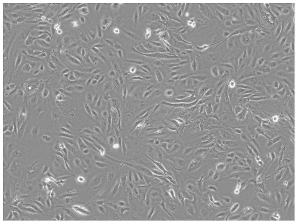 A kind of human normal renal tubule primary cell and its in vitro isolation culture and application