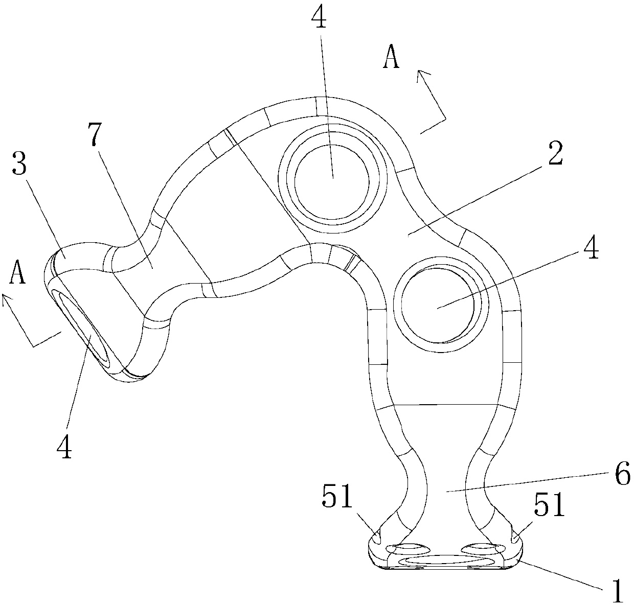 Calcaneus locking plate applied to tendo calcaneus avulsion fracture