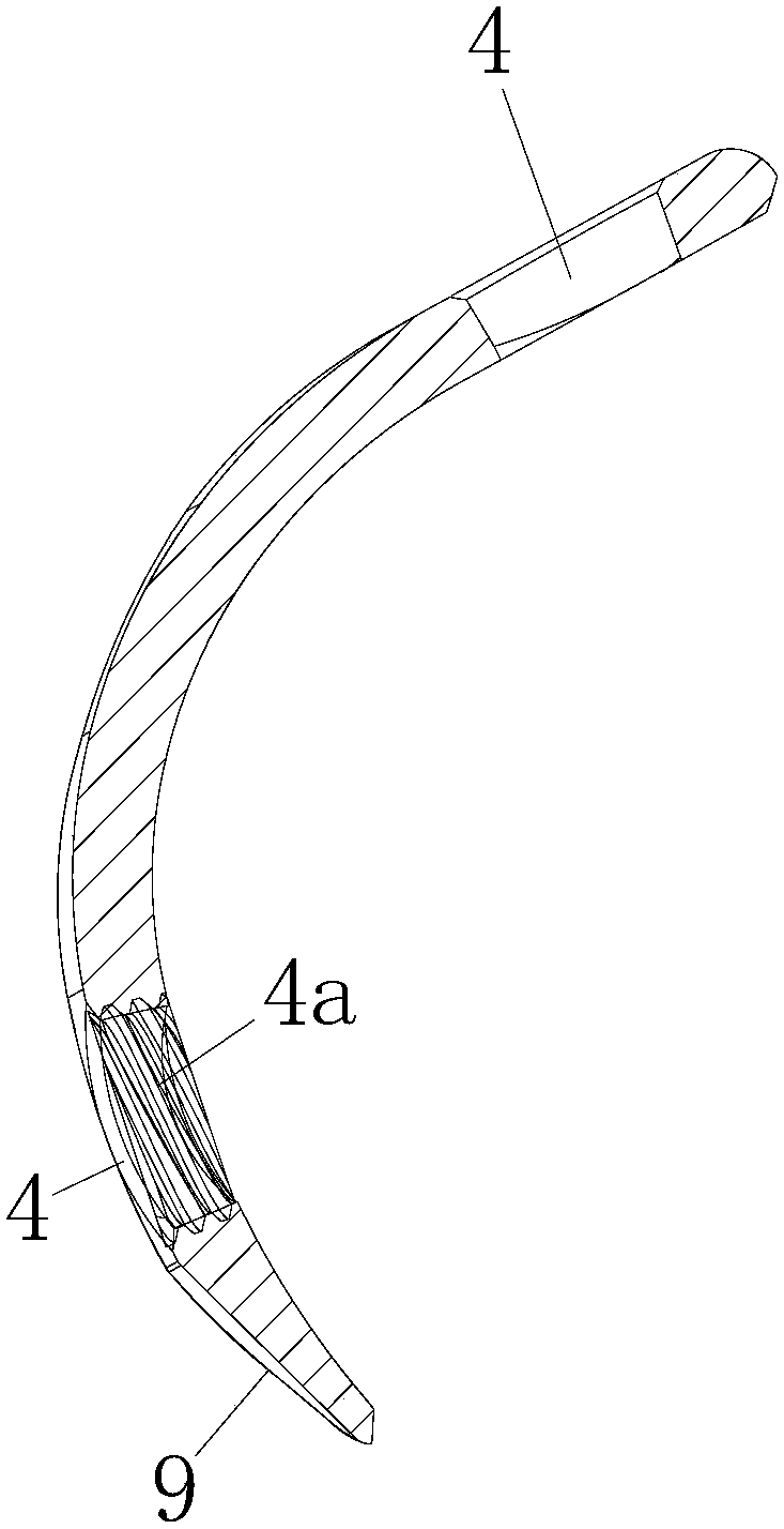 Calcaneus locking plate applied to tendo calcaneus avulsion fracture