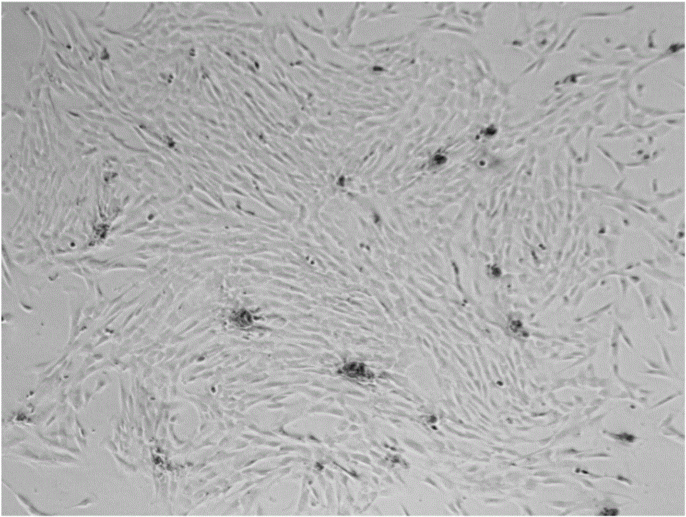 Method for preparing amniotic mesenchymal stem cells from human placenta amnion and application of amniotic mesenchymal stem cells