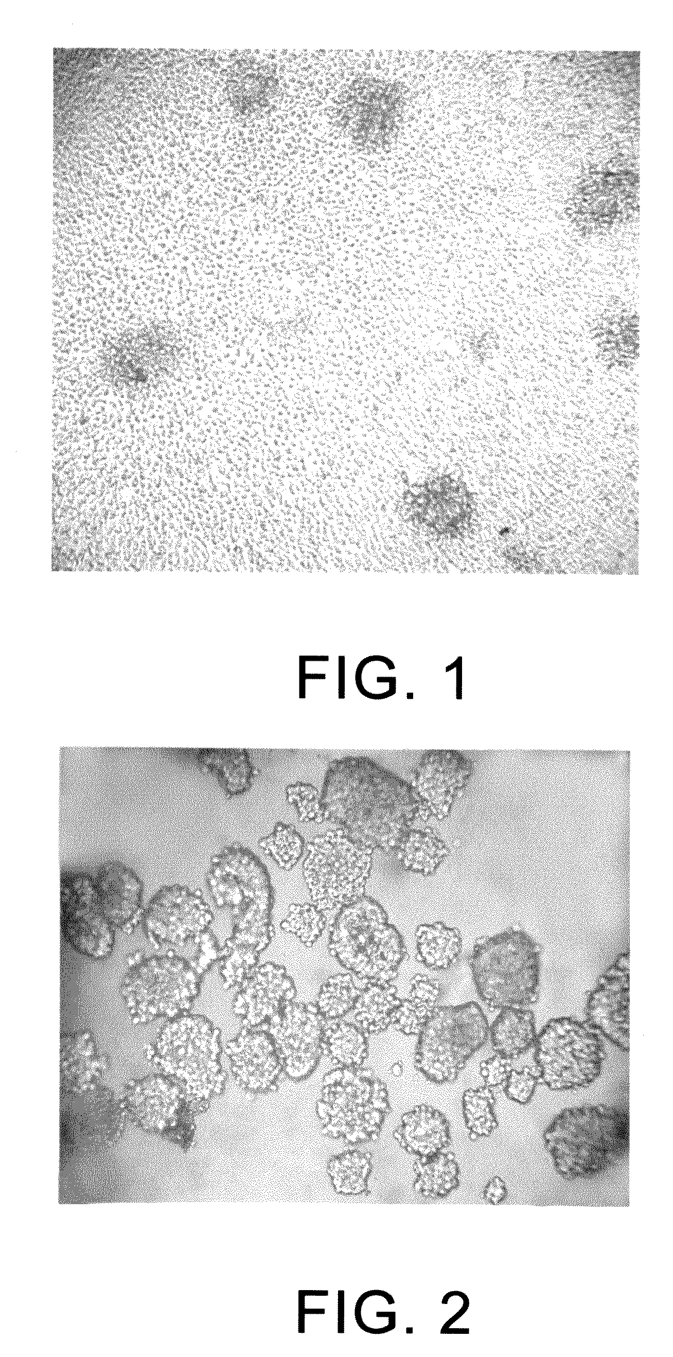 Method for culturing dendritic cells (DC) and cytokine-induced killer cells (D-CIK) and applications thereof
