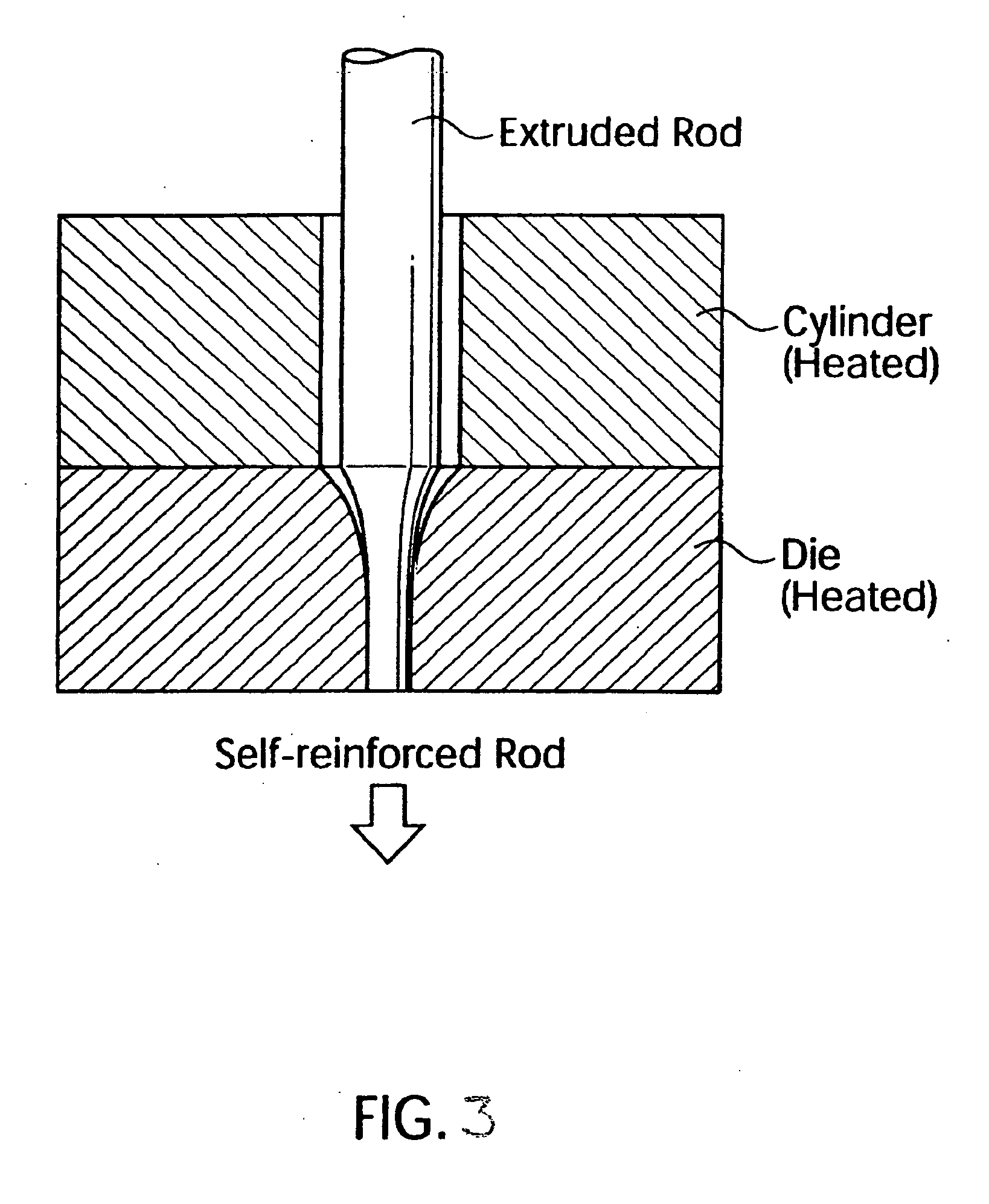 Multifunctional biodegradable composite and surgical implant comprising said composite