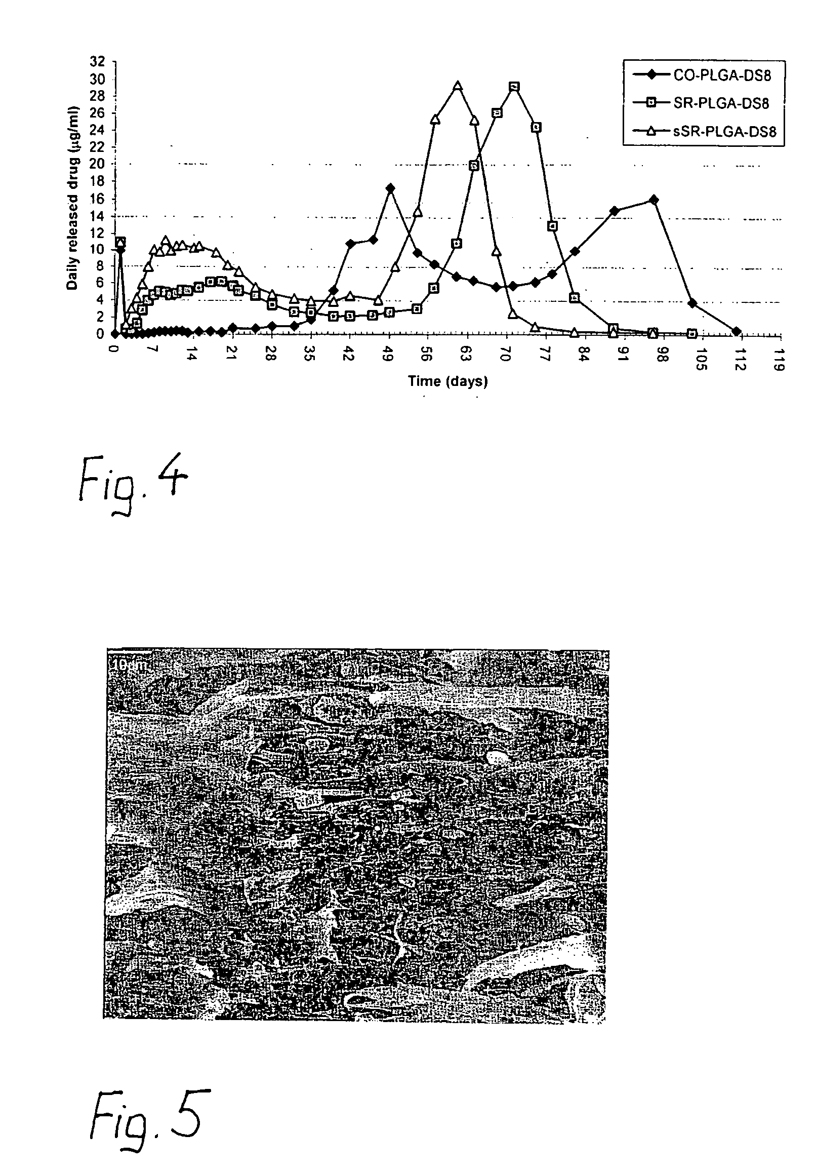 Multifunctional biodegradable composite and surgical implant comprising said composite