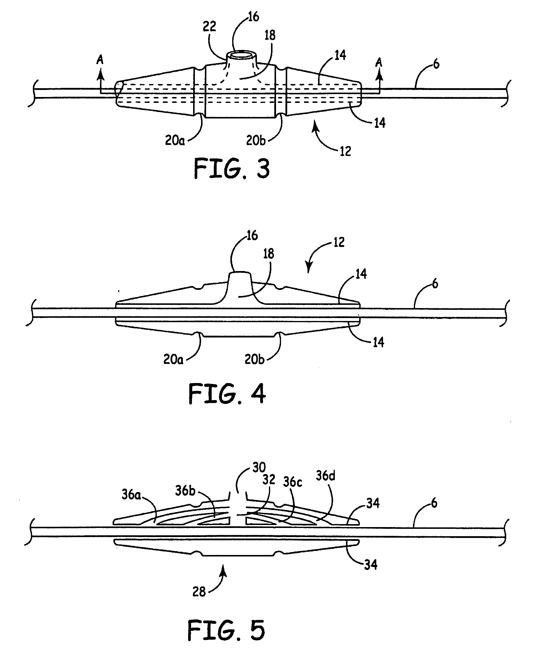 Anchor having fill port for use with an implantable therapy delivery element
