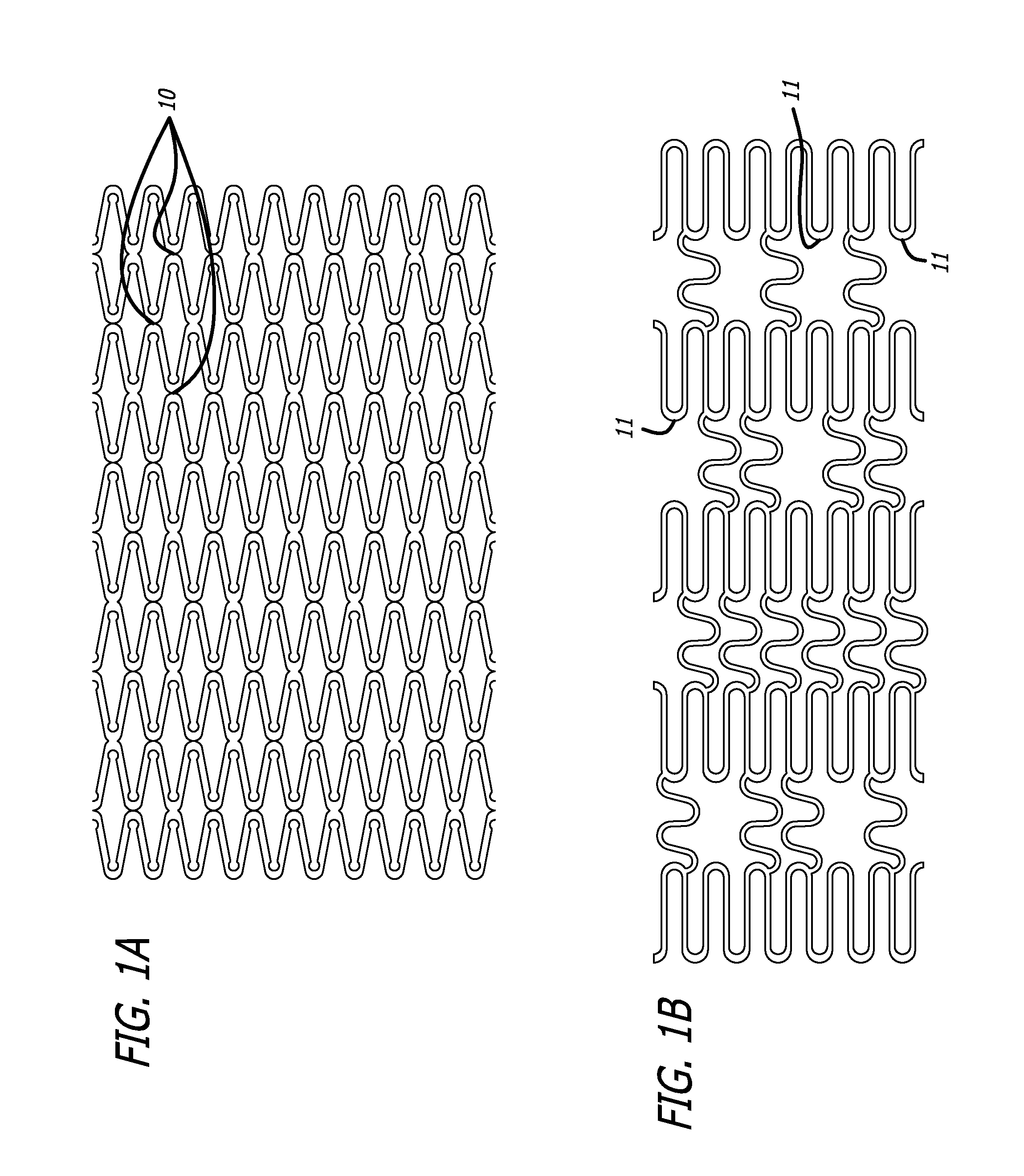 Slotted Self-Expanding Stent Delivery System