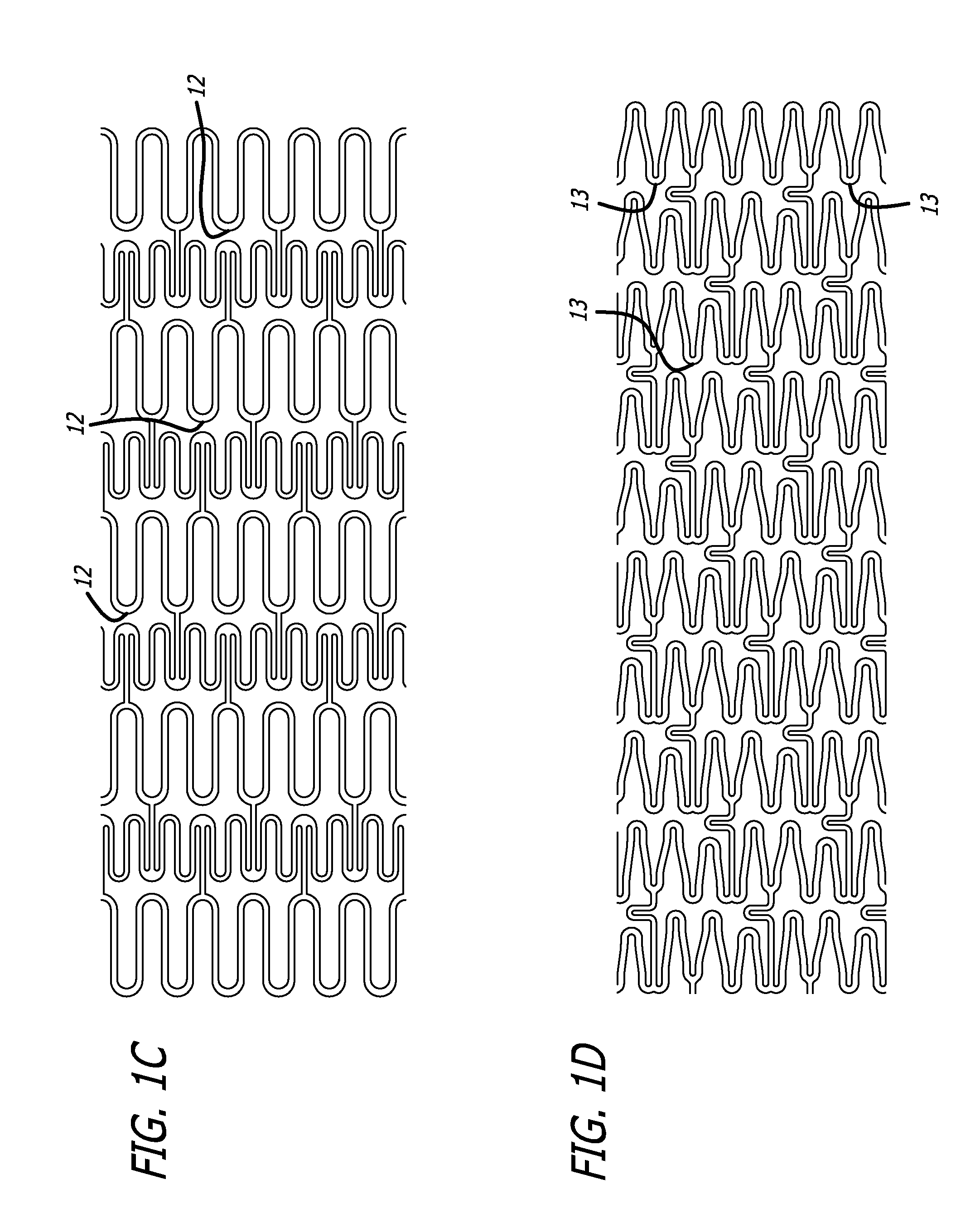 Slotted Self-Expanding Stent Delivery System