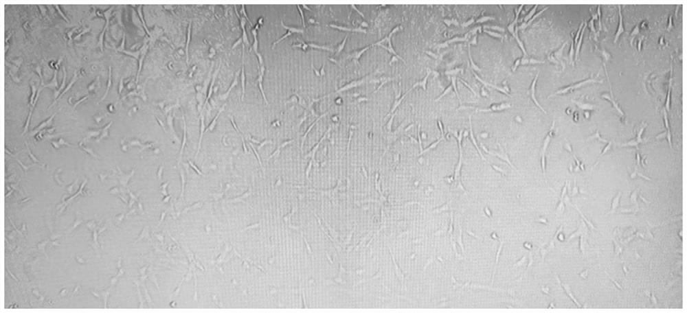 Method for separating and extracting cryopreserved adipose-derived stem cells from adipose