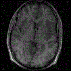 High-quality reconstruction method for parallel magnetic resonance imaging with joint total variation based on self-consistency