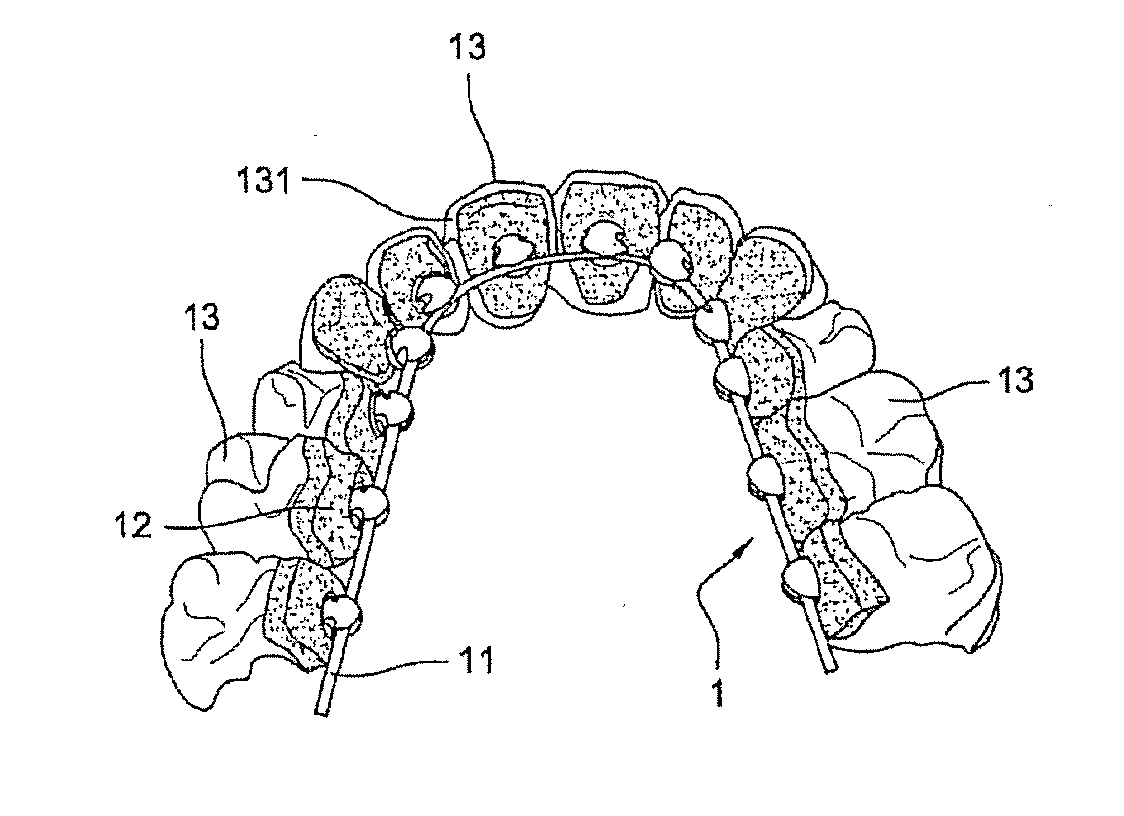 Method for Producing a Customized Orthodontic Appliance