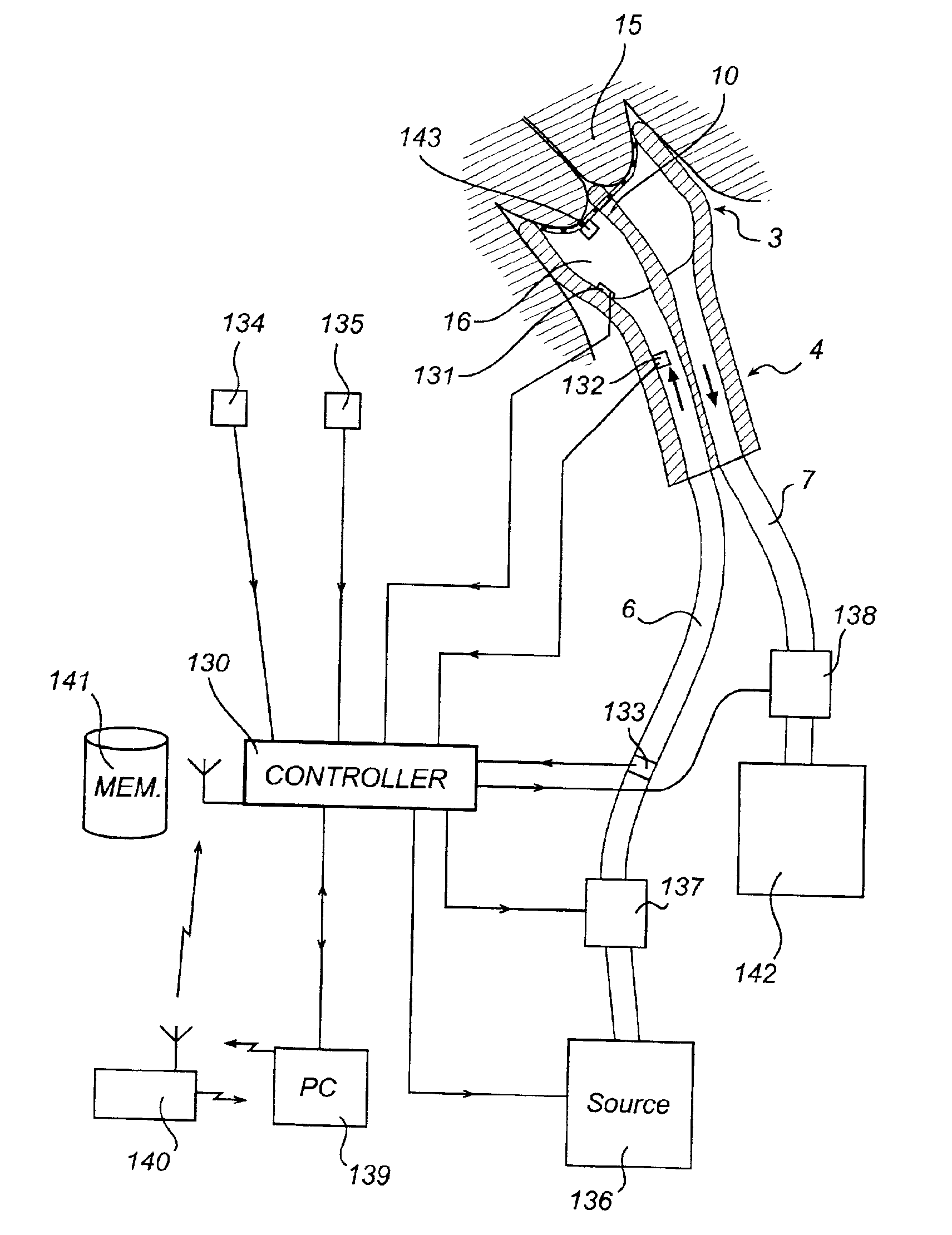 Method and device for treating inter alia the cervix