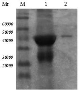 Trichinella spiralis 7tr protein human single-chain antibody, preparation method and medical application