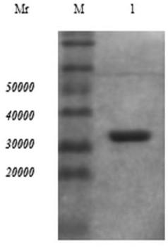 Trichinella spiralis 7tr protein human single-chain antibody, preparation method and medical application