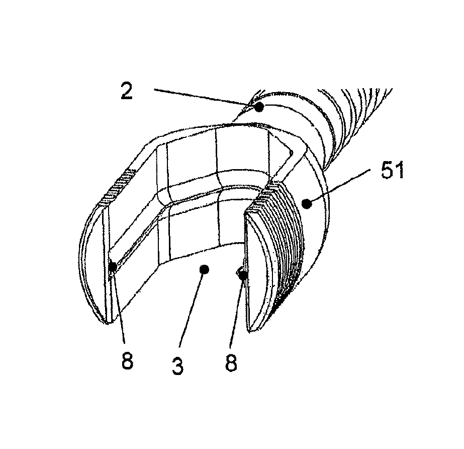 Anchorage arrangement for a connecting rod for the stabilization of the spine