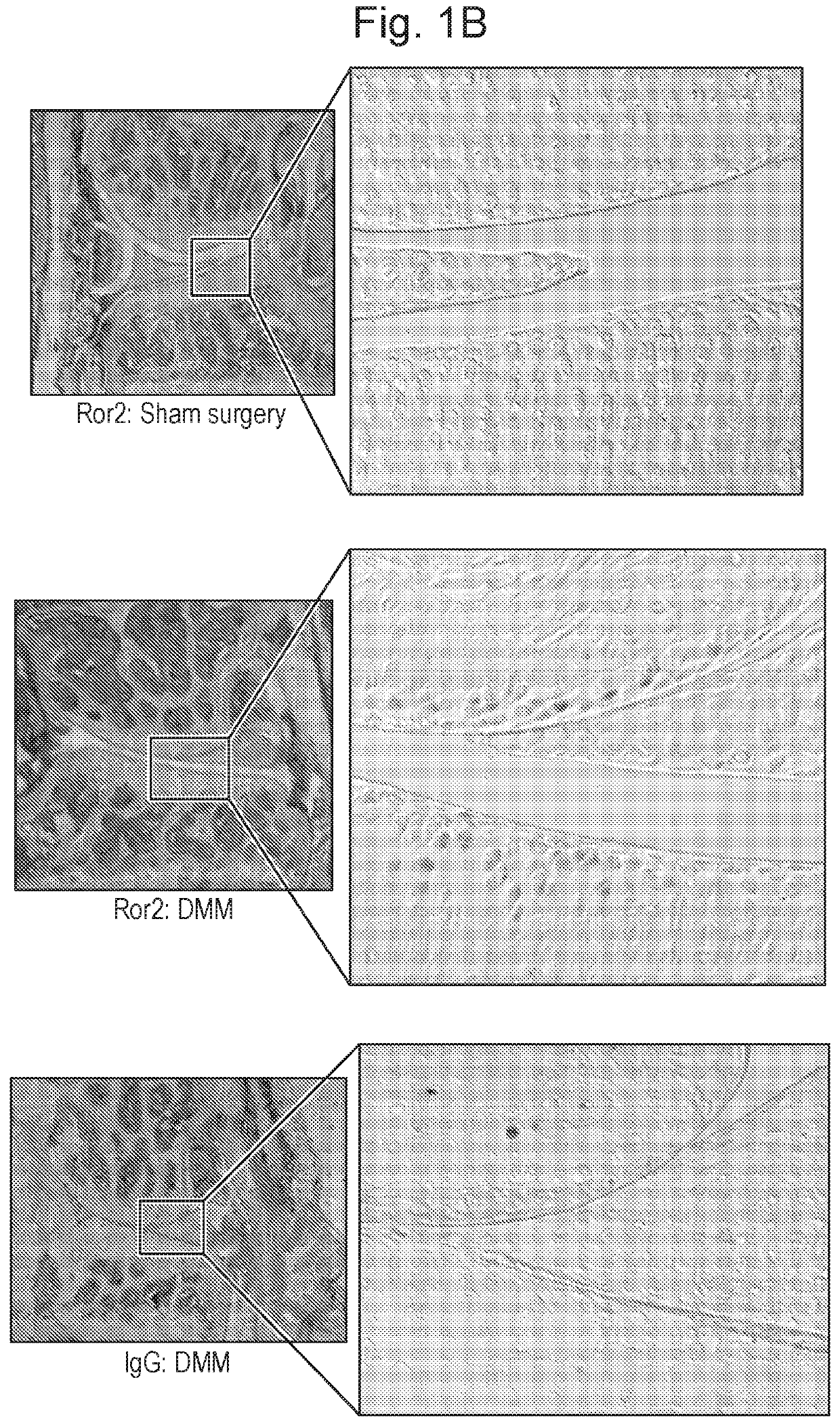 Ror2 inhibitors and use thereof in treating and/or preventing cartilage loss